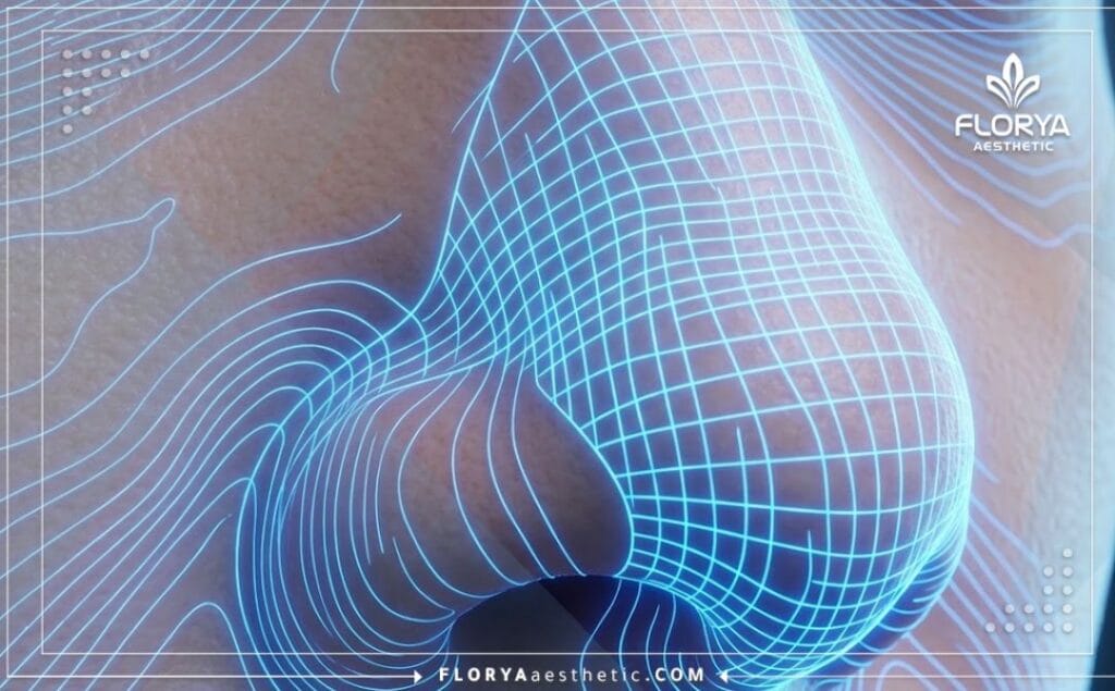 فحص رقمي ثلاثي الأبعاد لمنطقة الأنف والصمام الأنفي