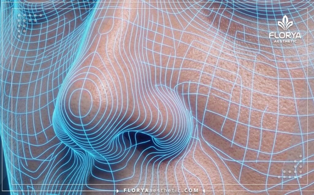 Scan 3D de haute technologie de la zone nasale montrant la précision du traitement.