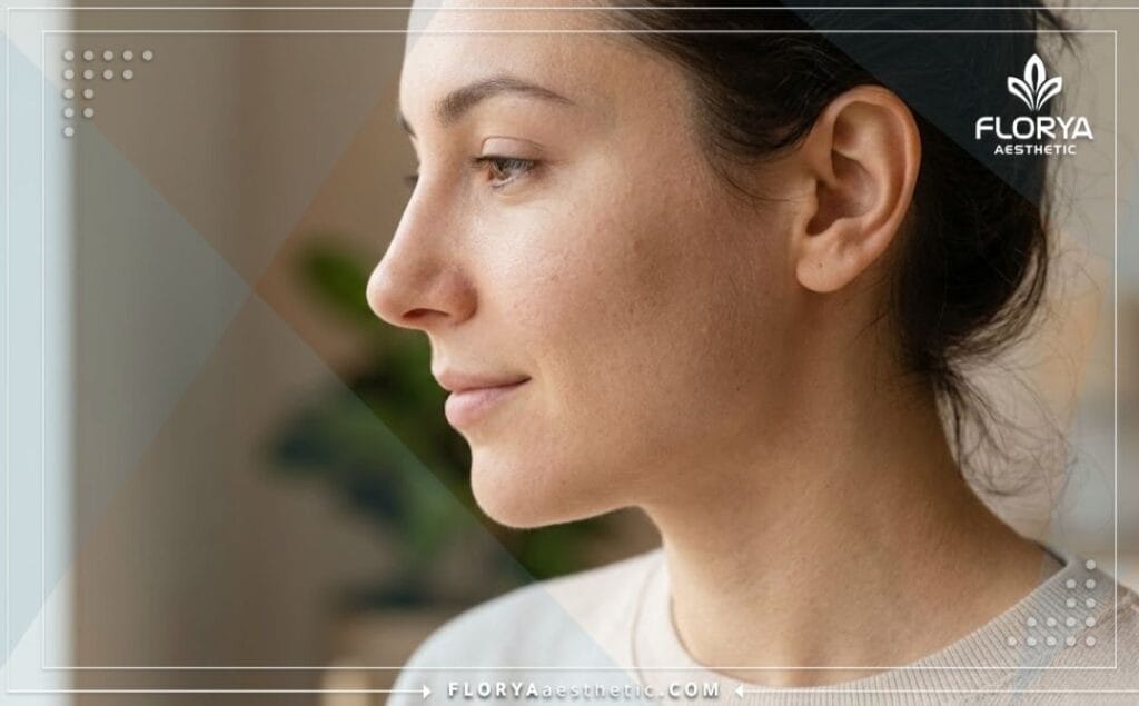 النتيجة النهائية المثالية والجمالية لمنطقة الأنف والوجه بعد العملية