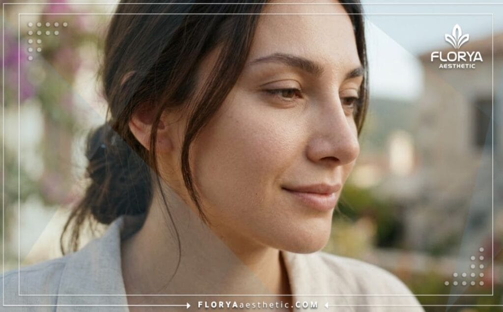 Close-up showing the flawless and natural aesthetic outcome of a secondary nose job.