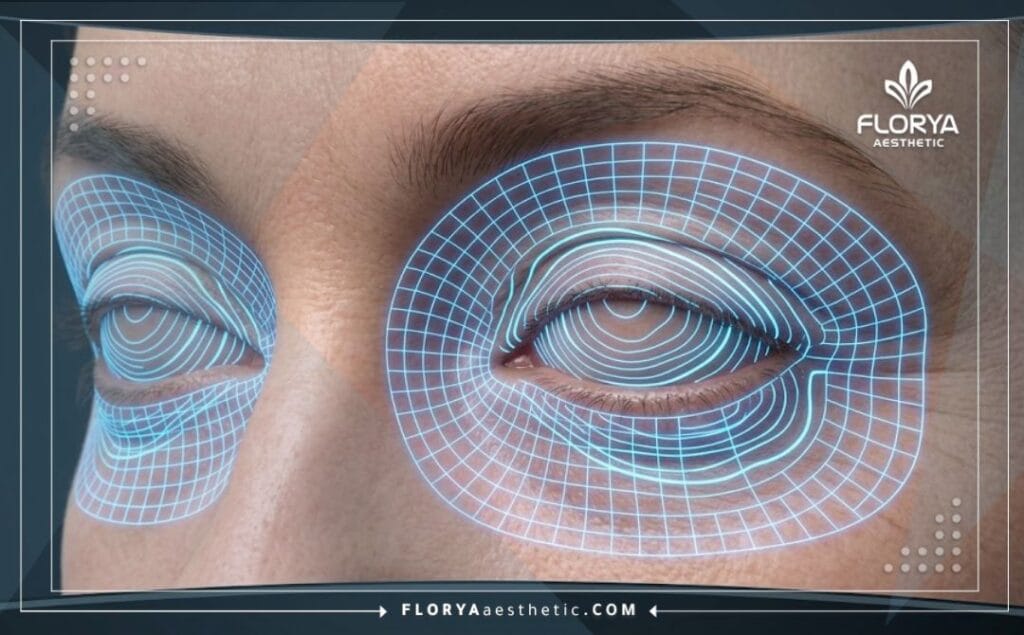 Balayage 3D haute technologie de la zone de la paupière et du contour des yeux