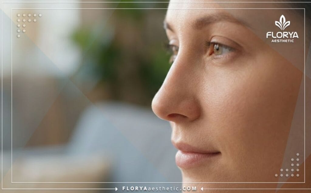 Gros plan sur un résultat esthétique parfait après une révision de rhinoplastie