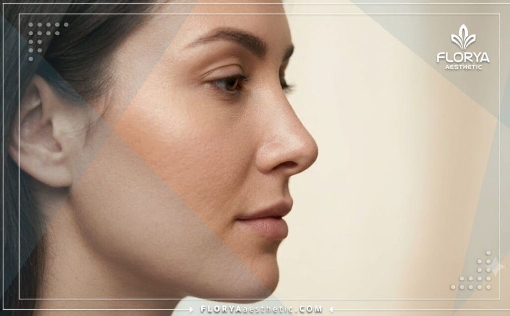 Flawless aesthetic result showing a perfectly sculpted nose profile