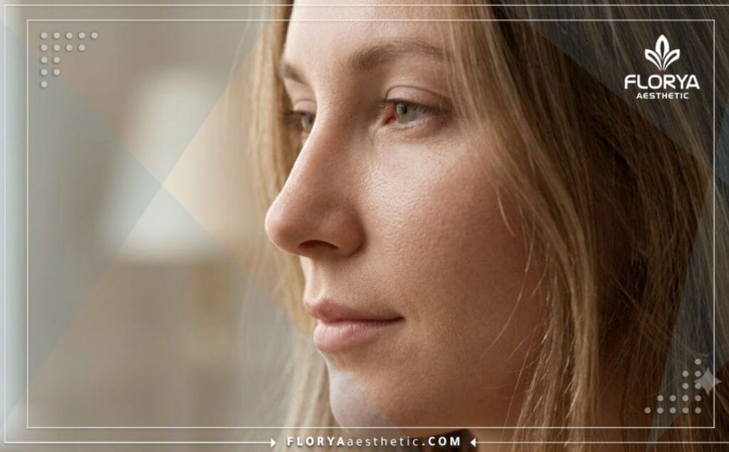 النتيجة المثالية والجمالية بعد عملية تجميل الأنف الناجحة