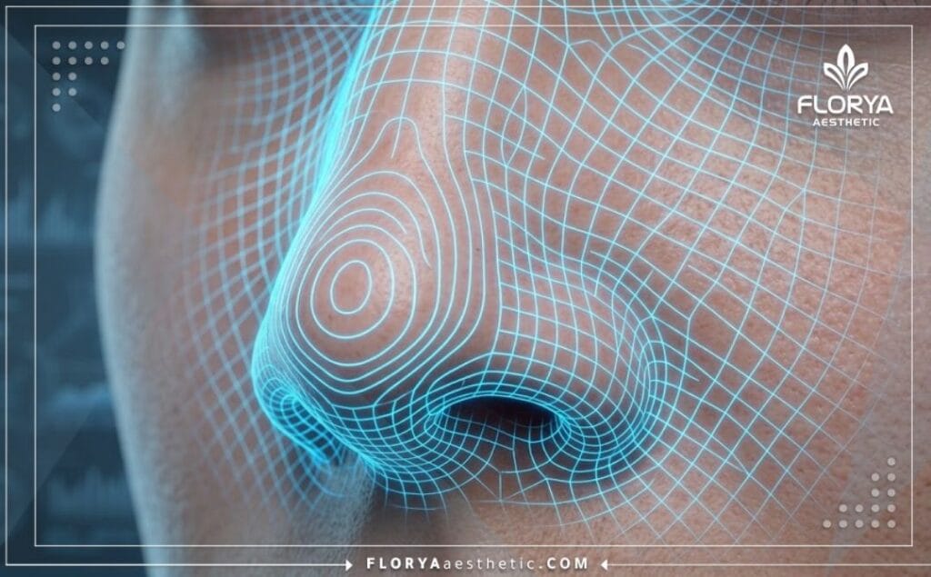 Digital 3D surface mesh scan of the nasal anatomical region for septoplasty planning