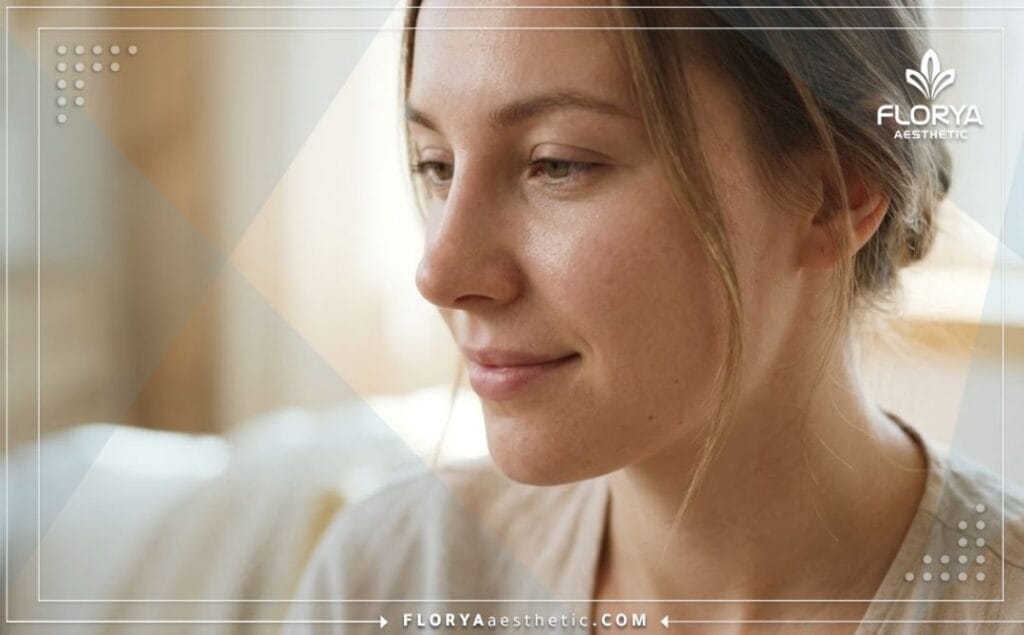 Flawless and highly natural outcome of an aesthetic nose surgery