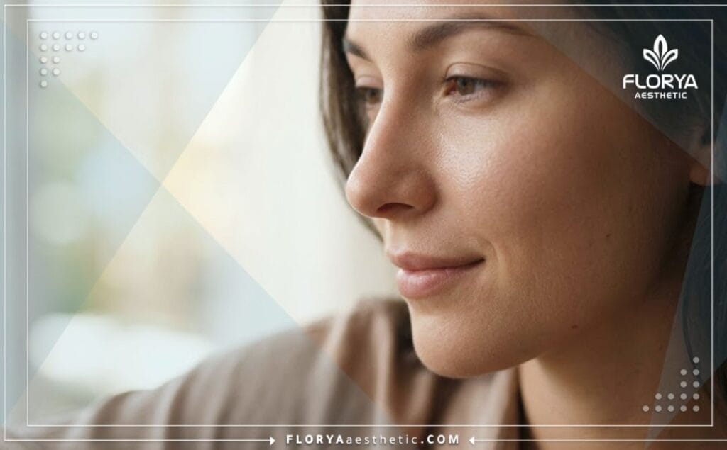 Résultat esthétique parfait et profil nasal affiné après une intervention réussie