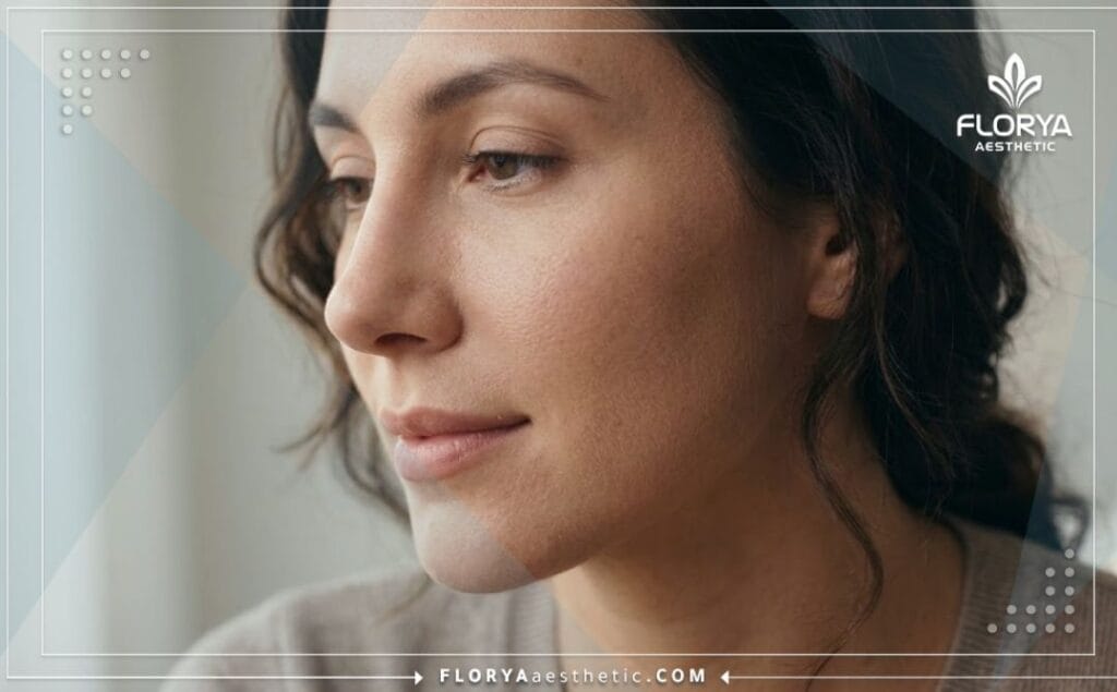 نتيجة مثالية وطبيعية لعملية تجميل الأنف من مسافة قريبة