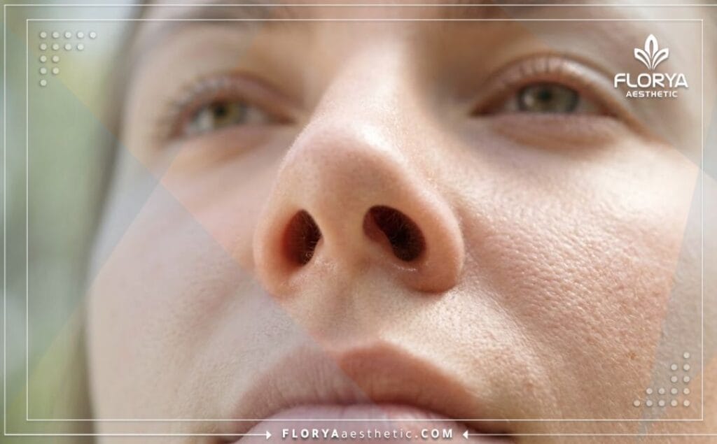 Résultat parfait garantissant une respiration saine et naturelle