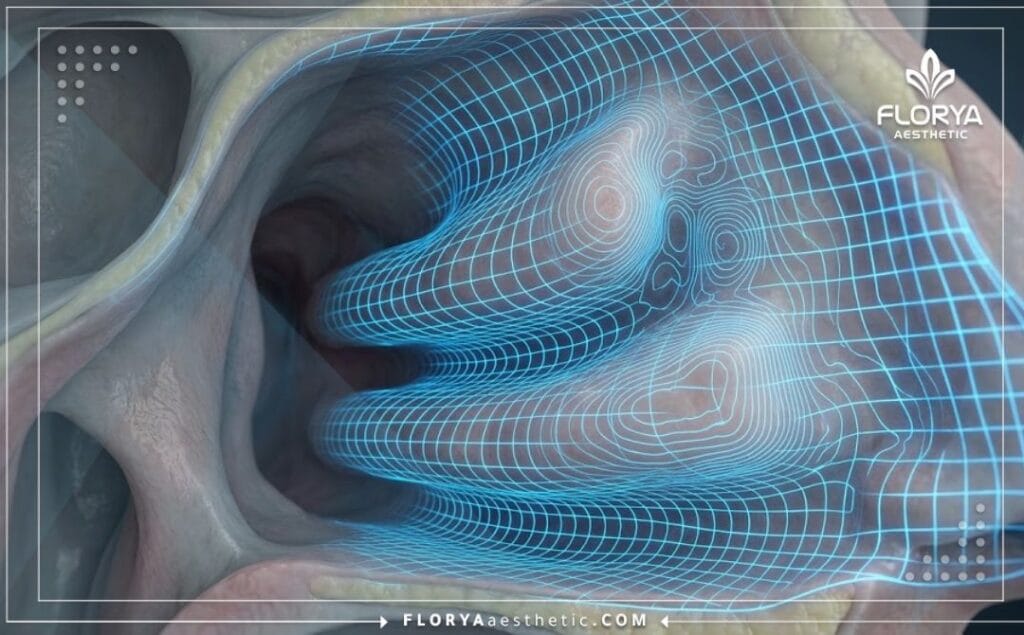 Modélisation 3D de haute précision de la cavité nasale